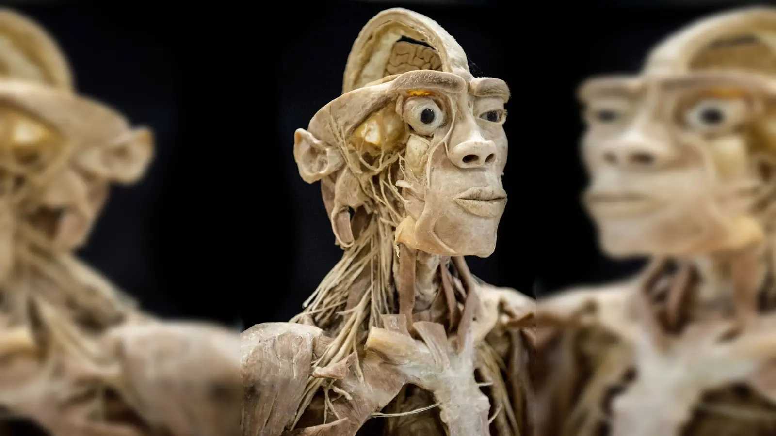 Die Ausstellung vermittelt anhand anatomischer Exponate Wissen über den menschlichen Körper. (Foto: Morten Stricker)