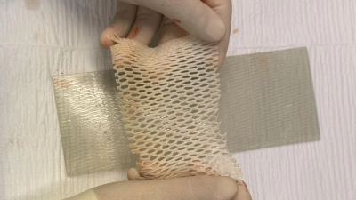 Mit der aufbereiteten Fischhaut des Kabeljaus lassen sich offene Wunden schließen. (Foto: Klinikum Freising)