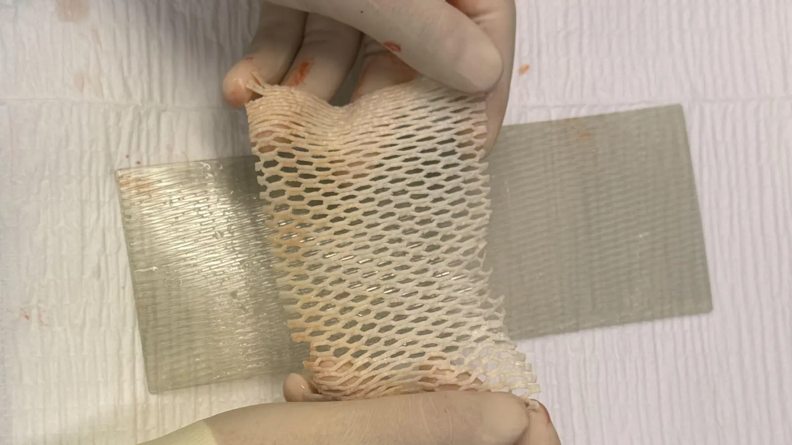 Mit der aufbereiteten Fischhaut des Kabeljaus lassen sich offene Wunden schließen. (Foto: Klinikum Freising)